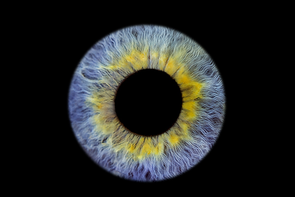 Enhanced eye photo result