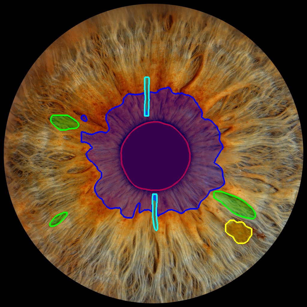 Iris Analysis Report Example