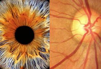 Iris Scan vs Retina Scan: Understanding the Differences